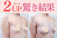オウキ 梅田北新地(OUKI.)