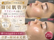 オンフリーク(ON FLEEK)