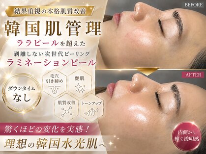 オンフリーク(ON FLEEK)の写真