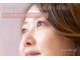アイディアル(eyedeal)の写真