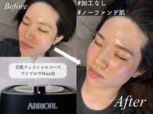 エヌワクシング バイナツ(N-Waxing bynatsu)