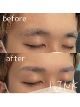 リンク(LINK)/眉毛症例