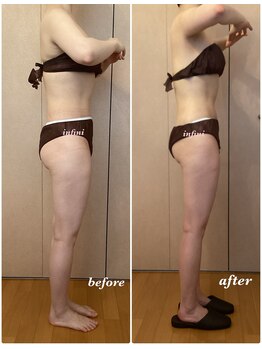 アンフィニ(infini)/短期集中コース4回目(2ヶ月)