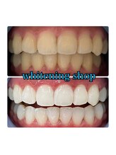 ホワイトニングショップ 所沢店/ホワイトニングショップ所沢店