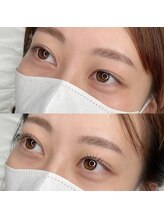 ケイ(Key.)/ラッシュリフト