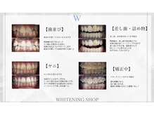 ホワイトニングショップ 八代店の雰囲気（こんな方にもオススメです♪）