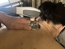 プラチナローズ(Platinum Rose)/インディバ(首、肩)