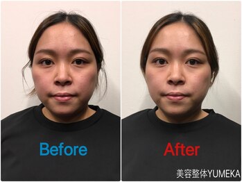 美容整体ユメカ(美容整体YUMEKA)/小顔矯正でリフトアップ!