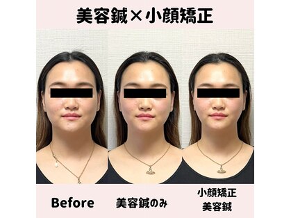 ワッカ 広尾(WACCA)の写真