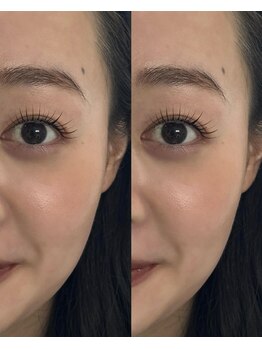 フー(fuu)/Mylamination