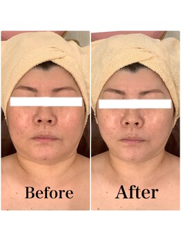 スペチアーレ 夙川/小顔と美肌で美顔革命