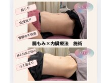 ラクーラビューティー(Lacu-ra Beauty)