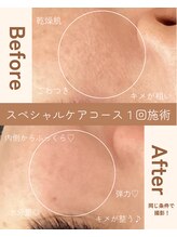 ミュー 豊田店(mieux)/◆お肌のキメが若さの秘訣♪