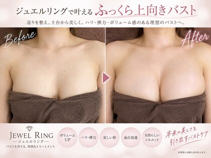ジュエルリング(Jewel Ring)の写真