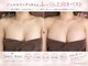 ジュエルリング(Jewel Ring)の写真