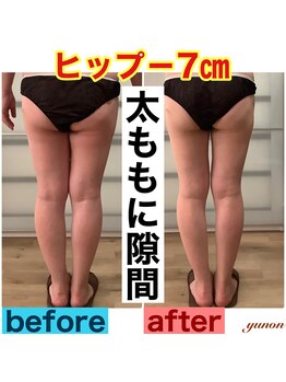 ユノン(yunon)/ビフォーアフター★