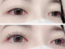 ビタミン(Vitamin*)/