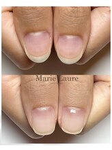 マリーロール 梅田店(Marie Laure)/自爪育成/深爪矯正/ネイルケア