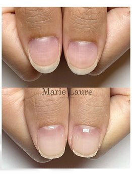 マリーロール 梅田店(Marie Laure)/自爪育成/深爪矯正/ネイルケア
