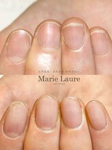 マリーロール 淀屋橋本店(Marie Laure)/自爪育成/深爪矯正/ネイルケア