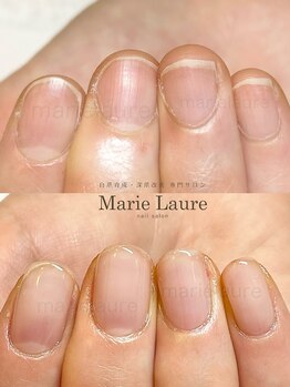 マリーロール 淀屋橋本店(Marie Laure)/自爪育成/深爪矯正/ネイルケア