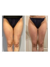 ルナグランデ 心斎橋店(Luna grande.)/膝上スッキリで脚長効果