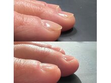 ネイルサロン モカ(moka)の雰囲気(『1回目ケア後から爪を噛む癖がなくなりました』3ヶ月ご卒業)