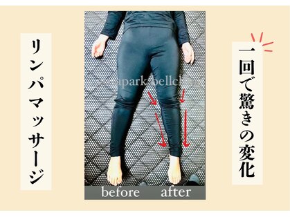 ヨサパーク ベルクロエ(YOSA PARK)の写真