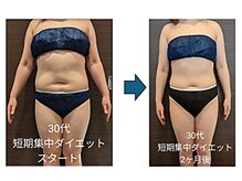 ローブメール(Robemail)/ビフォーアフター