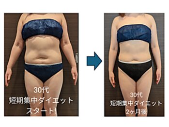 ローブメール(Robemail)/ビフォーアフター