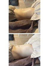 ヴァローレ(valore)/腸もみ/骨盤調整/全身調整