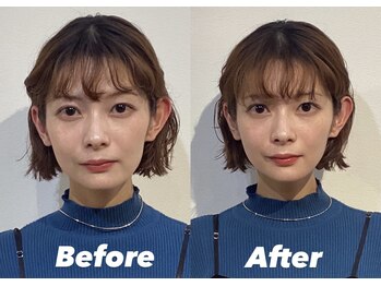 コルミチョン サロン(骨美整 salon)/Before・After