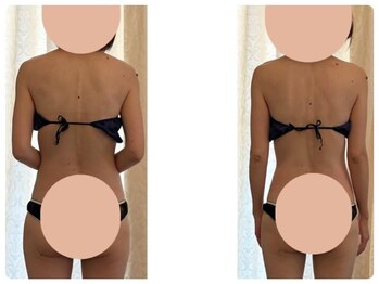 ココロ(COCO.RO)/上半身ビフォーアフター