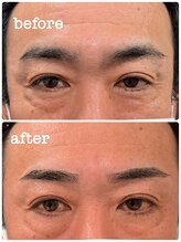 オーメンズ 名古屋店/メンズ眉毛wax/眉毛サロン