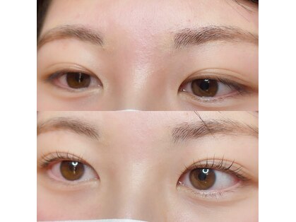 トータルビューティ アップスタイル(UPSTYLE)の写真