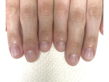 シープラス/ジェルを使った自爪育成