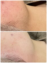 リノベル(LINOBELLE)/一度で素肌美人