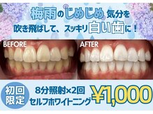 LBSホワイトニング 上野店