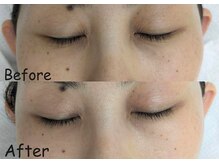 マインドール/乾燥シワケア対策