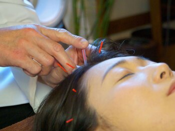 レメディの写真/《豊中》毛髪診断士/育毛促進特化鍼灸師が科学的根拠に基づいた施術をご提供。頭と身体の鍼灸施術で改善へ