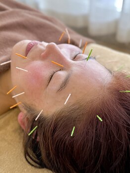 まこと鍼灸院の写真/50代からの美しさは、ぶれないこと。気になるほうれい線・たるみへ徹底アプローチ！凛と引き締まった表情に