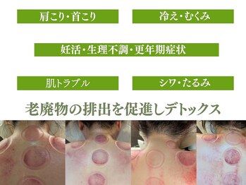 水玉屋(suidamaya)/蓄積された老廃物の排出を促進
