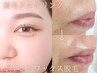 【美眉＆くすみやシワに見える産毛脱毛】眉毛WAX＋顔1パーツのワックス脱毛