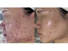テンニック(10nick)の雰囲気（完全"1対1"で、人や環境によって変わるお肌の状態を徹底管理。）