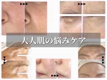まぁ ま 西葛西店の雰囲気（実例＆口コミはインスタ参照　　　 maama_salon (まぁま_さろん)）