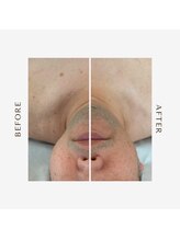 ラヴィ(La vie)/最新インディバフェイシャル/men