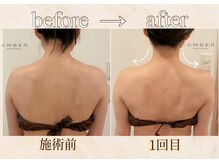 アンバー 恵比寿(AMBER)/辛い首や肩凝りに