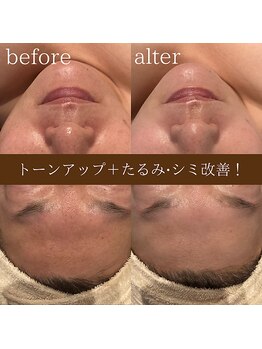 ディースズ(D.suzu)/復元パックbefore/after