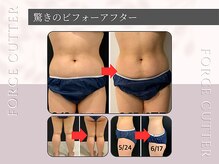 スパチャーレ(Spa ciare)の雰囲気（しっかり結果なら！スパチャーレにお任せください）