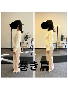 熊本カワル整体 JR上熊本駅院/巻き肩